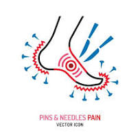 4. Đau dây thần kinh